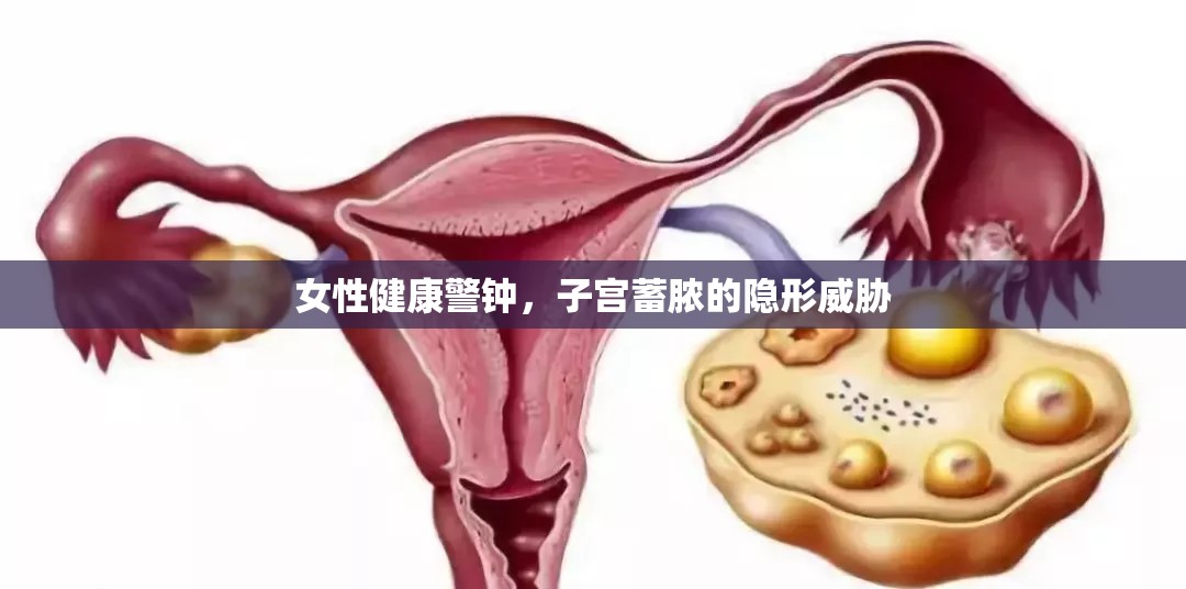 女性健康警鐘，子宮蓄膿的隱形威脅