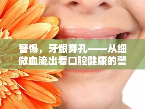 警惕，牙齦穿孔——從細(xì)微血流出看口腔健康的警鐘