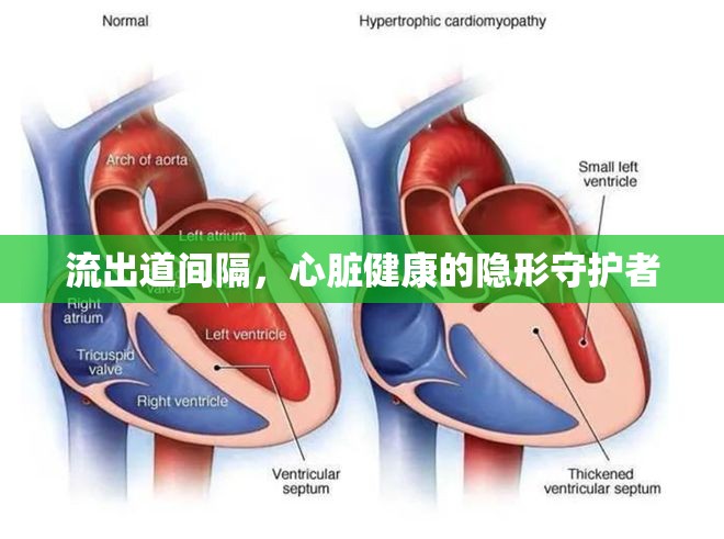 流出道間隔，心臟健康的隱形守護(hù)者