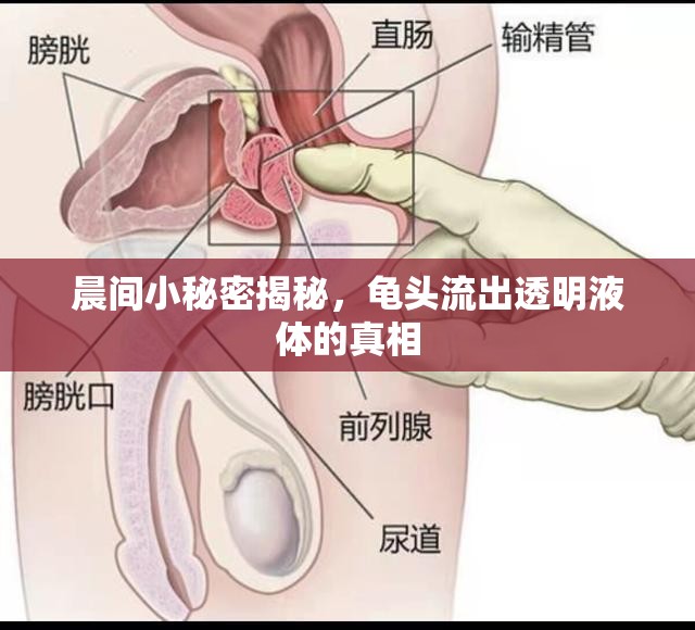 晨間小秘密揭秘，龜頭流出透明液體的真相