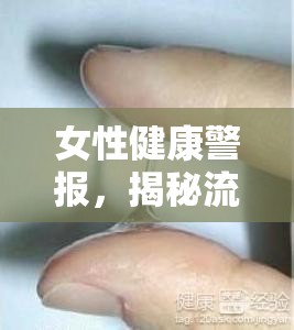 女性健康警報，揭秘流出濃稠黃綠色分泌物的背后真相