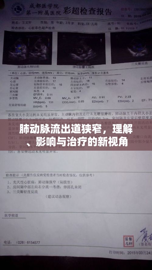 肺動脈流出道狹窄，理解、影響與治療的新視角