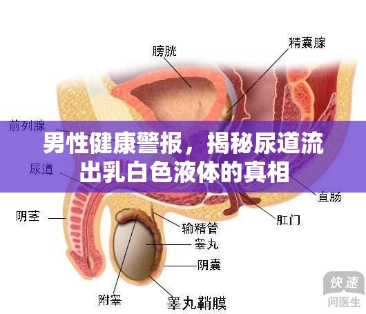 男性健康警報(bào)，揭秘尿道流出乳白色液體的真相