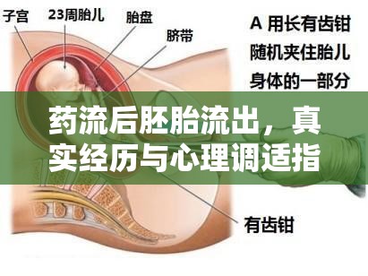 藥流后胚胎流出，真實經(jīng)歷與心理調(diào)適指南