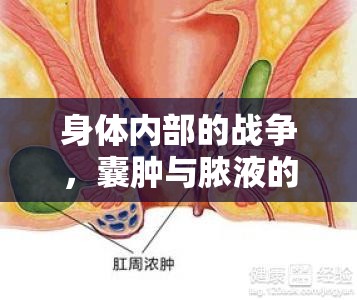 身體內(nèi)部的戰(zhàn)爭(zhēng)，囊腫與膿液的較量