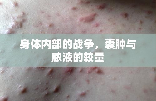 身體內(nèi)部的戰(zhàn)爭(zhēng)，囊腫與膿液的較量