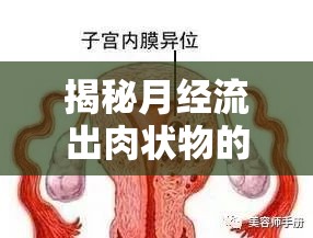 揭秘月經(jīng)流出肉狀物的真相，生理現(xiàn)象與健康解讀