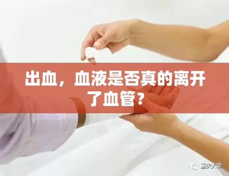 出血，血液是否真的離開了血管？