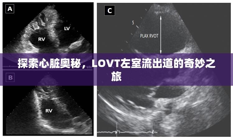 探索心臟奧秘，LOVT左室流出道的奇妙之旅