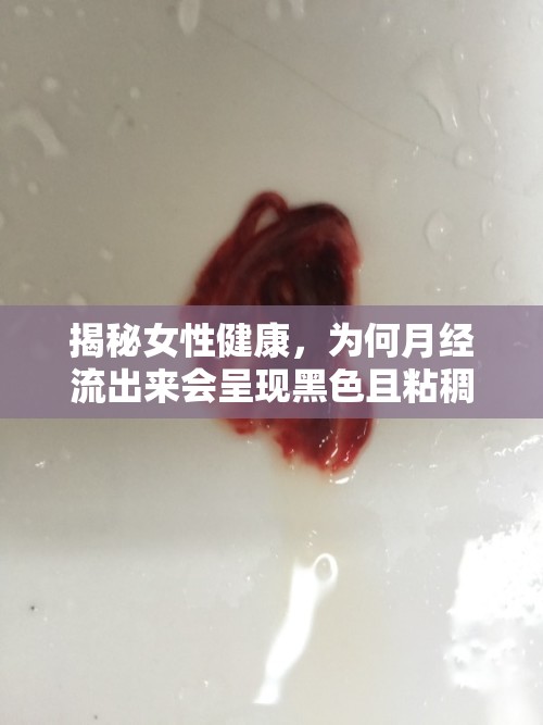 揭秘女性健康，為何月經(jīng)流出來會(huì)呈現(xiàn)黑色且粘稠？