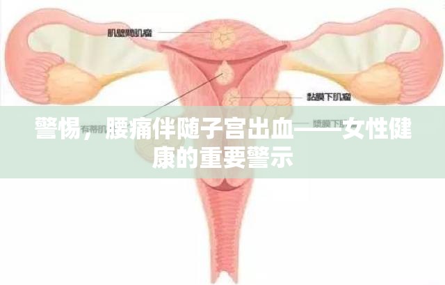 警惕，腰痛伴隨子宮出血——女性健康的重要警示