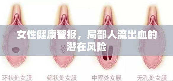 女性健康警報，局部人流出血的潛在風(fēng)險