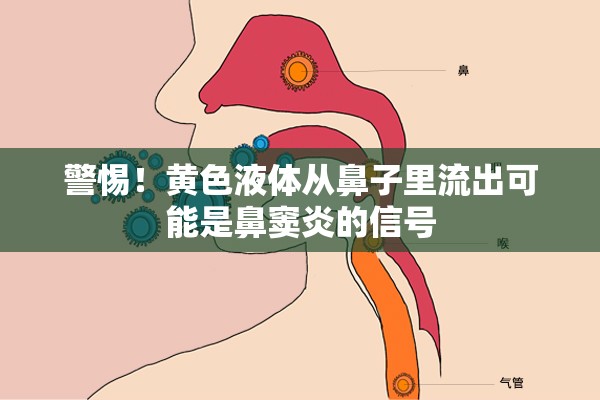 警惕！黃色液體從鼻子里流出可能是鼻竇炎的信號