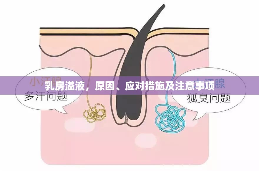 乳房溢液，原因、應(yīng)對措施及注意事項