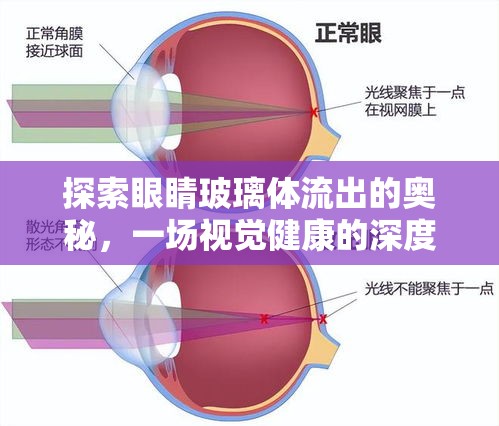 探索眼睛玻璃體流出的奧秘，一場(chǎng)視覺(jué)健康的深度科學(xué)之旅