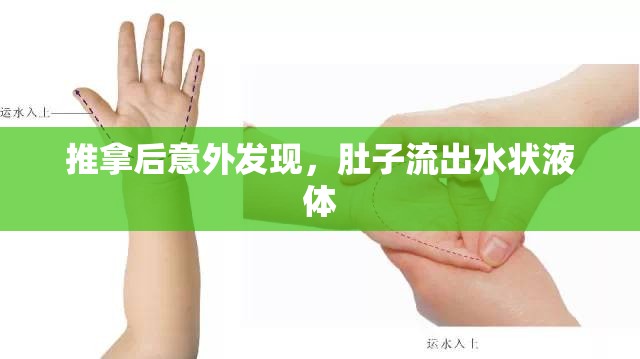 推拿后意外發(fā)現(xiàn)，肚子流出水狀液體