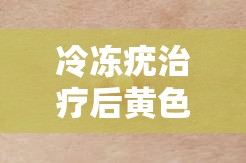 冷凍疣治療后黃色液體真相揭秘，了解那股黃色警報