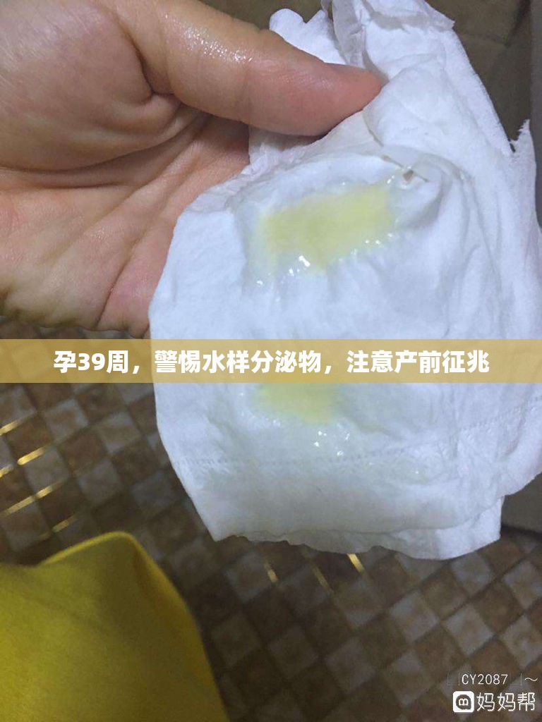 孕39周，警惕水樣分泌物，注意產(chǎn)前征兆