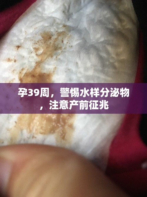 孕39周，警惕水樣分泌物，注意產(chǎn)前征兆