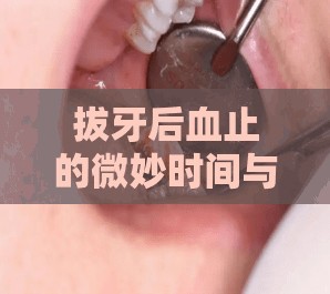 拔牙后血止的微妙時間與愈合平衡