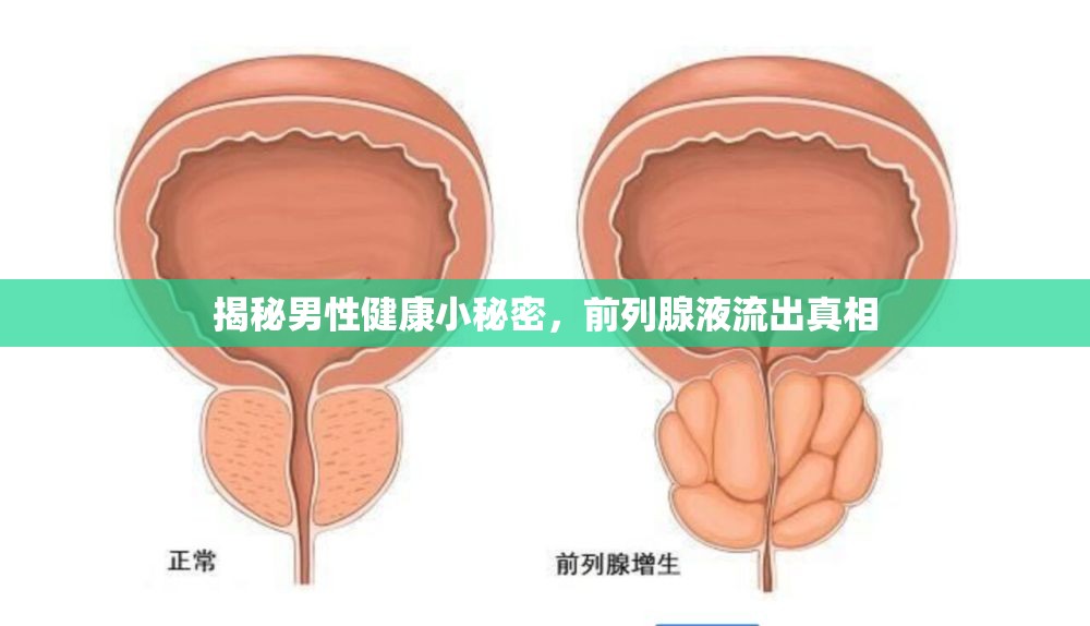 揭秘男性健康小秘密，前列腺液流出真相