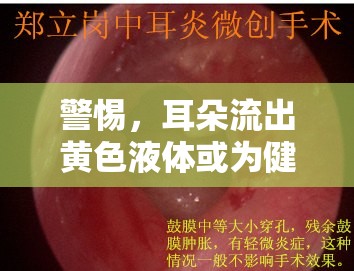 警惕，耳朵流出黃色液體或?yàn)榻】稻瘓?bào)