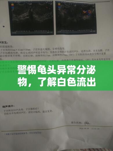 警惕龜頭異常分泌物，了解白色流出的真相與應對措施