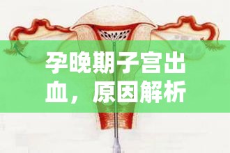 孕晚期子宮出血，原因解析與應(yīng)對策略