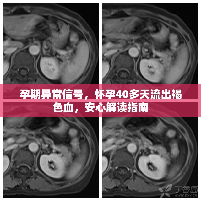 孕期異常信號(hào)，懷孕40多天流出褐色血，安心解讀指南