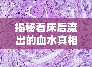 揭秘著床后流出的血水真相與應(yīng)對(duì)策略