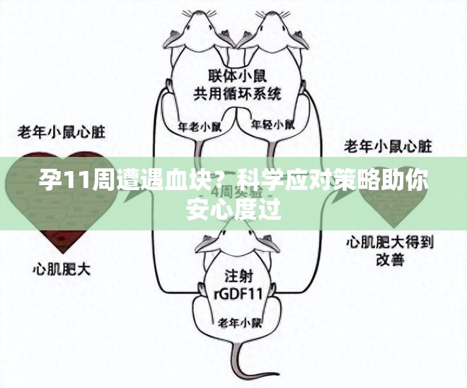 孕11周遭遇血塊？科學(xué)應(yīng)對策略助你安心度過