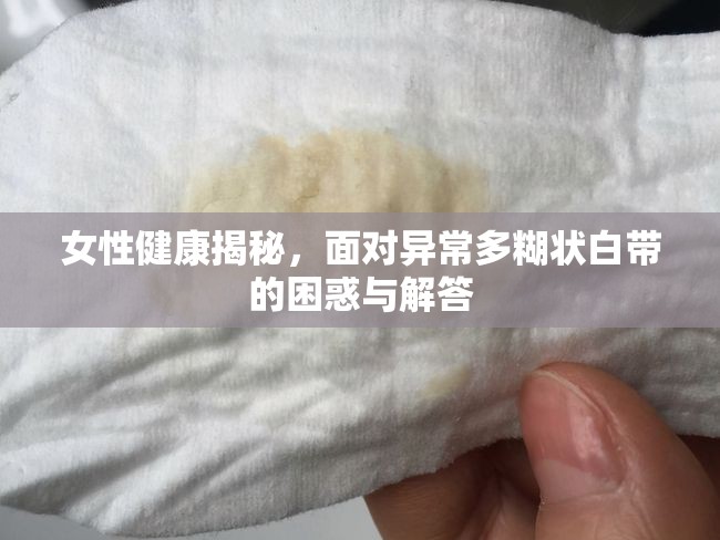 女性健康揭秘，面對異常多糊狀白帶的困惑與解答