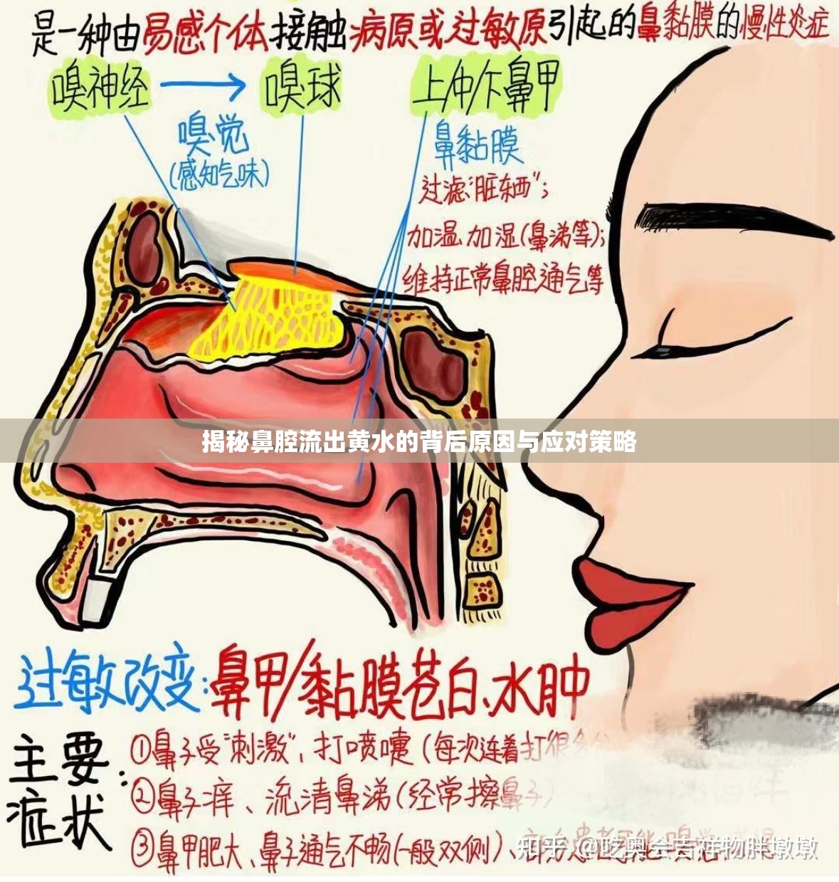 揭秘鼻腔流出黃水的背后原因與應(yīng)對(duì)策略