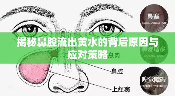 揭秘鼻腔流出黃水的背后原因與應(yīng)對策略