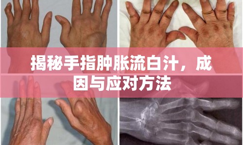 揭秘手指腫脹流白汁，成因與應(yīng)對方法