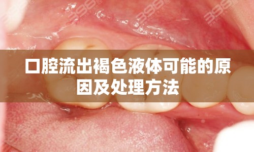 口腔流出褐色液體可能的原因及處理方法