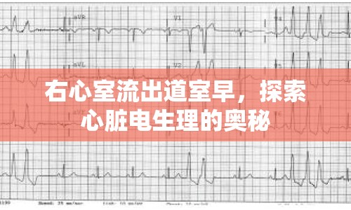 右心室流出道室早，探索心臟電生理的奧秘