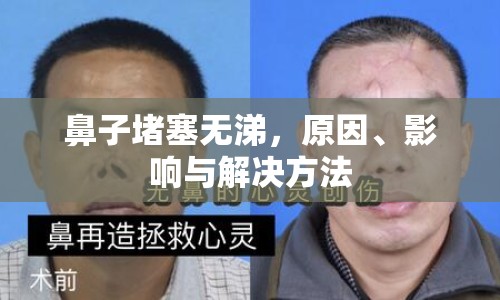 鼻子堵塞無涕，原因、影響與解決方法