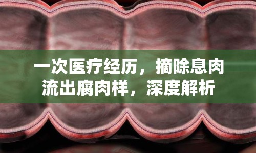 一次醫(yī)療經(jīng)歷，摘除息肉流出腐肉樣，深度解析