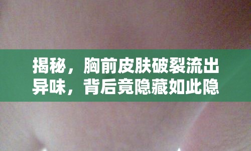 揭秘，胸前皮膚破裂流出異味，背后竟隱藏如此隱秘傷口！