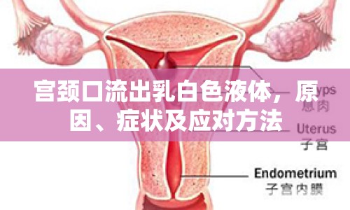 宮頸口流出乳白色液體，原因、癥狀及應(yīng)對方法