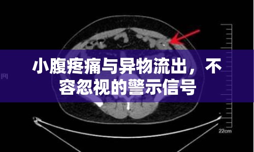 小腹疼痛與異物流出，不容忽視的警示信號