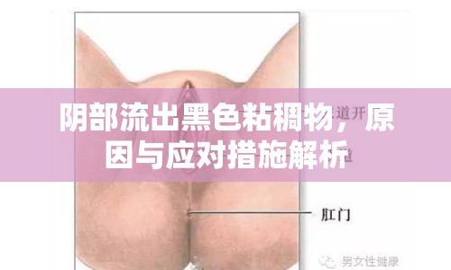 陰部流出黑色粘稠物，原因與應對措施解析