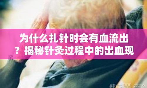 為什么扎針時會有血流出？揭秘針灸過程中的出血現(xiàn)象