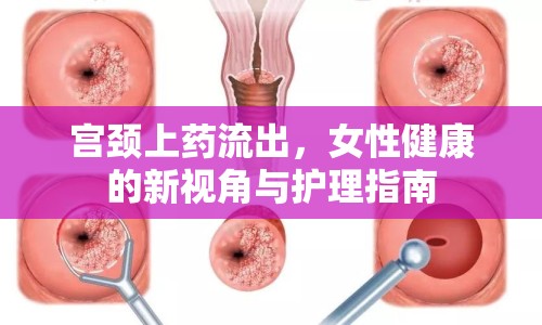 宮頸上藥流出，女性健康的新視角與護(hù)理指南