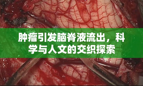 腫瘤引發(fā)腦脊液流出，科學與人文的交織探索