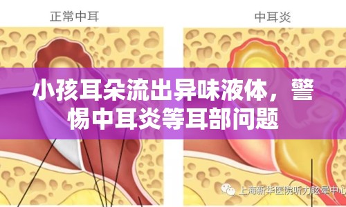 小孩耳朵流出異味液體，警惕中耳炎等耳部問題