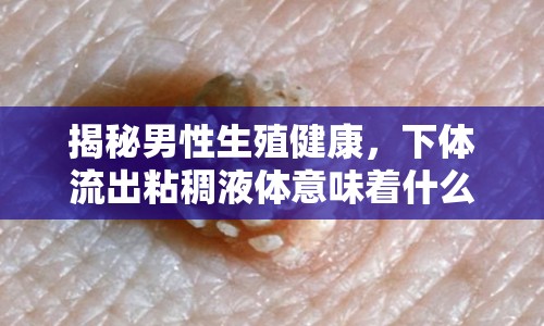 揭秘男性生殖健康，下體流出粘稠液體意味著什么？