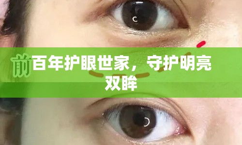 百年護(hù)眼世家，守護(hù)明亮雙眸