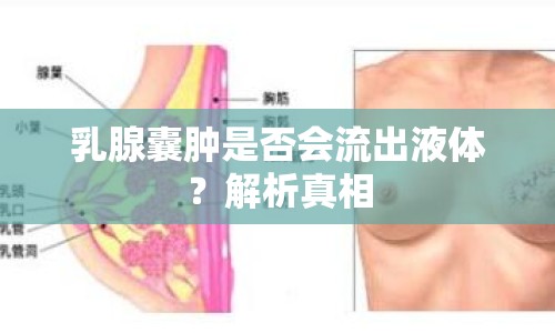 乳腺囊腫是否會(huì)流出液體？解析真相